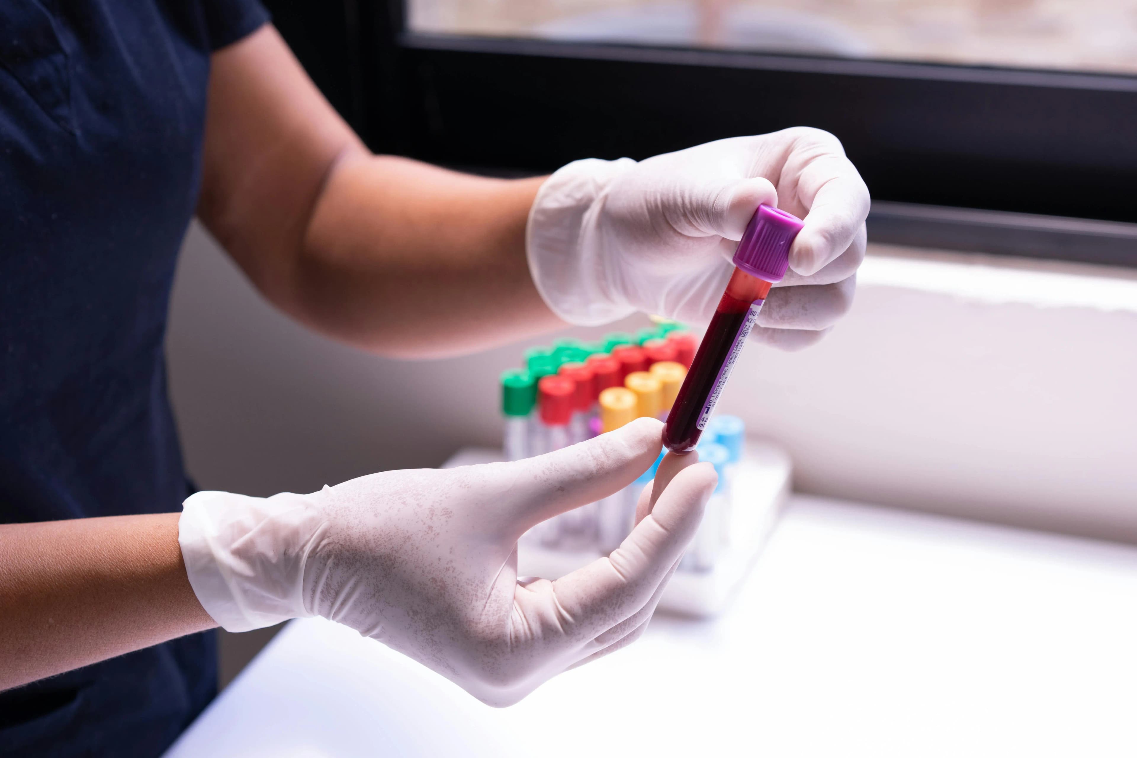 Start Smart: 5 Baseline Tests Your Primary-Care Doctor Recommends